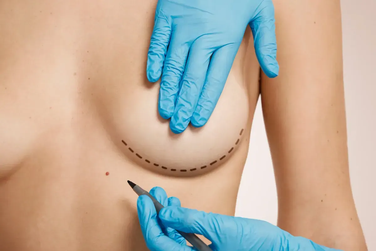Breast Firming