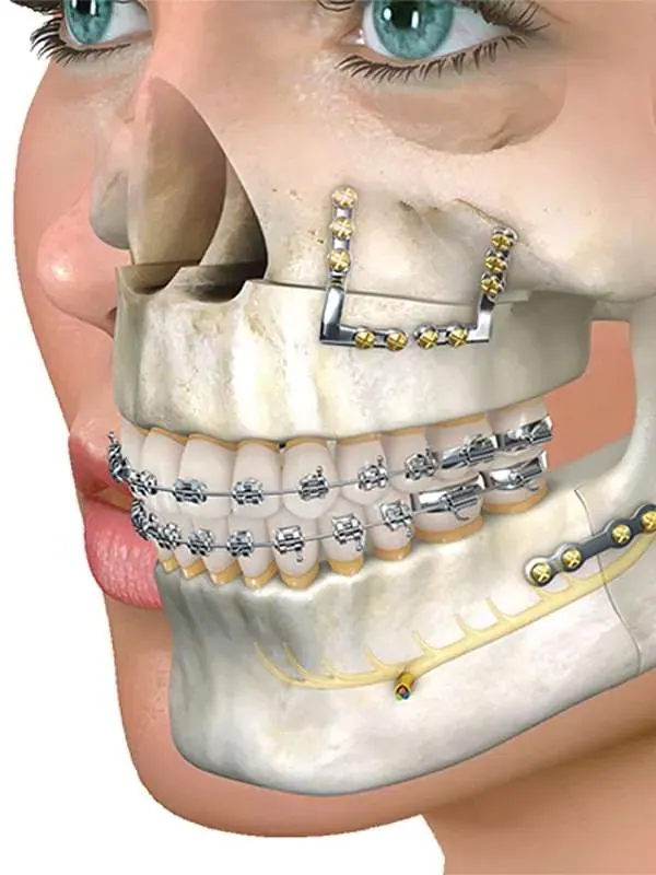 Deformity Correction