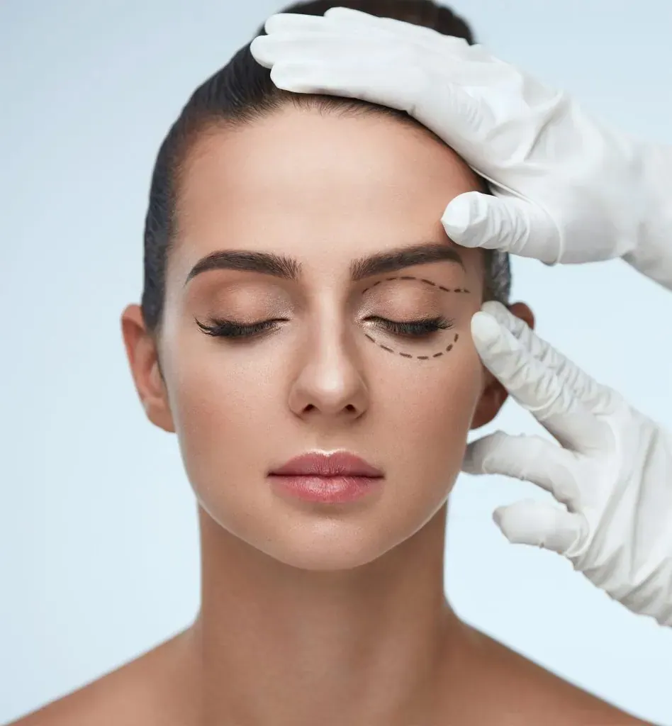 Eyelid Surgery (Blepharoplasty)