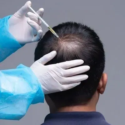 Hair Loss Treatment in Aligarh — Dr. Amit Agrawal