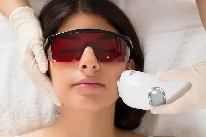 Laser Hair Removal