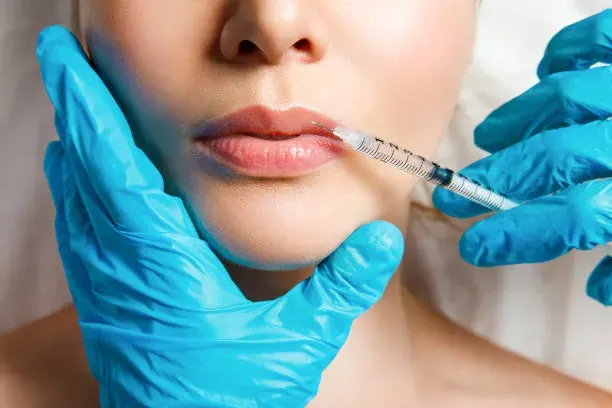Lips Correction (Lip Reshaping Surgery)
