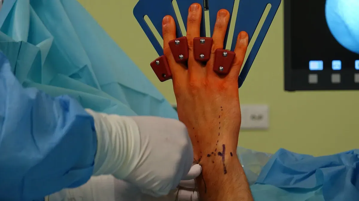 Nerve, Tendon & Bone Surgery