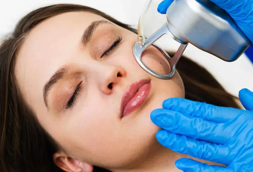 Skin Tightening