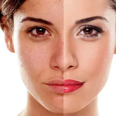 Facial Renewal